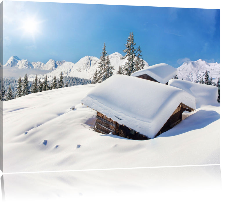 Pixxprint Berghütten in den Alpen, Leinwandbild